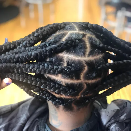 Close-up of a client's scalp with neatly parted and braided box braids.
